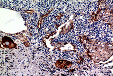 Mucin 1 Polyclonal Antibody[41