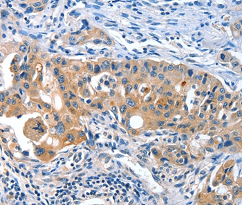 AMHR2 Antibody[36093]