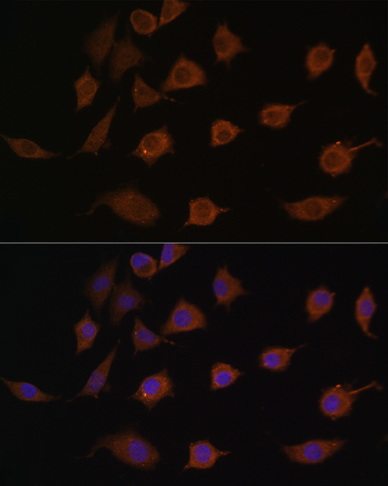 LSM1 Rabbit Polyclonal Antibod