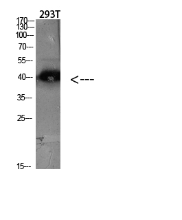 CKR-5 Polyclonal Antibody[4676
