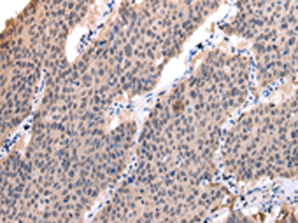 POLR2K Antibody[42880]