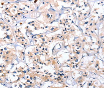 CATSPER1 Antibody[36313]