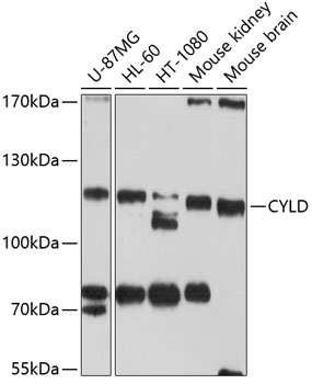 CYLD Rabbit Polyclonal Antibod