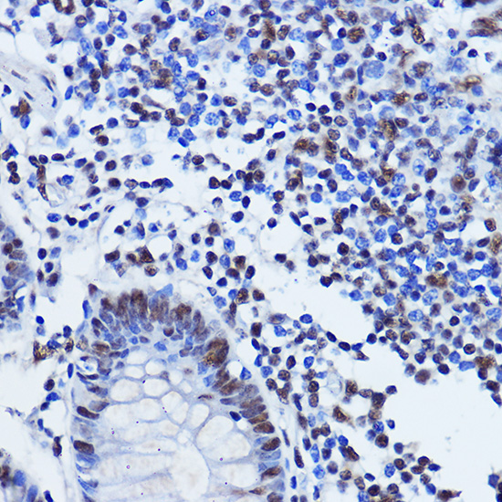 TARDBP Rabbit Polyclonal Antib