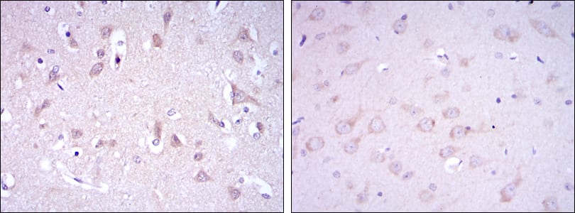 GRIA3 Mouse mAb[63690]
