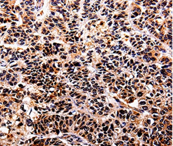 IL10RA Antibody[35598]