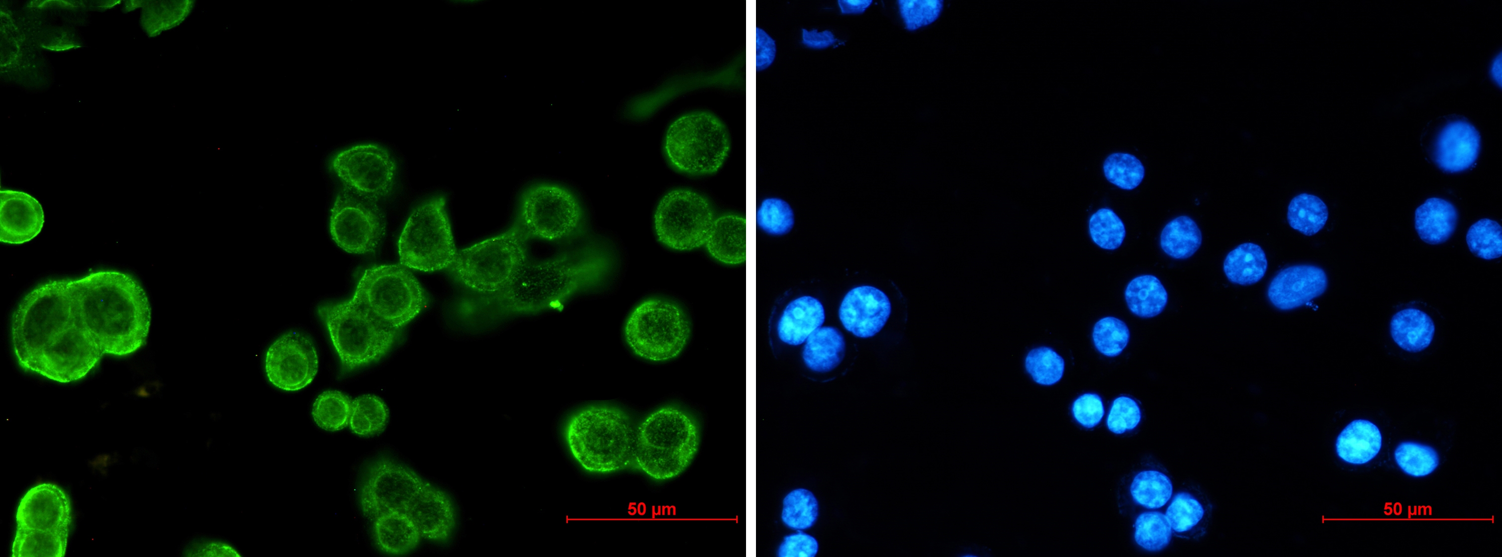 Cadherin Rabbit mAb[52486]
