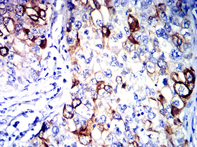 CDKN1A Mouse mAb[63449]