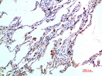 Eotaxin-2 Polyclonal Antibody[