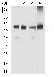 KRT9 Mouse mAb[63852]