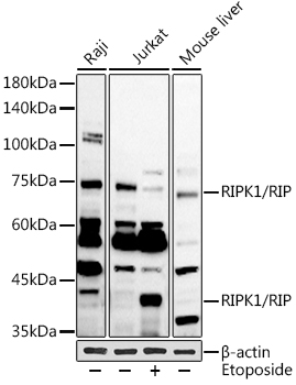 RIPK1 Rabbit Polyclonal Antibo
