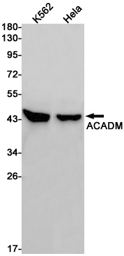 ACADM Rabbit mAb[52115]