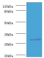 ureA Polyclonal Antibody[42580