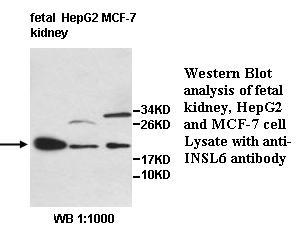 INSL6 Antibody[39604]