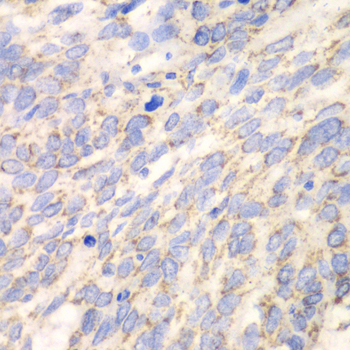 DLD Rabbit Polyclonal Antibody