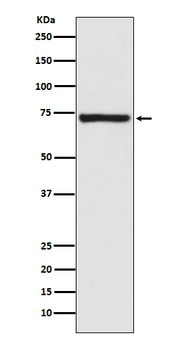 Calpain 1 Rabbit mAb[56175]