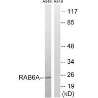 RAB6A Antibody[34972]