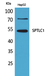 SPTLC1 Polyclonal Antibody[416