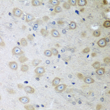 ATAD3A Rabbit Polyclonal Antib