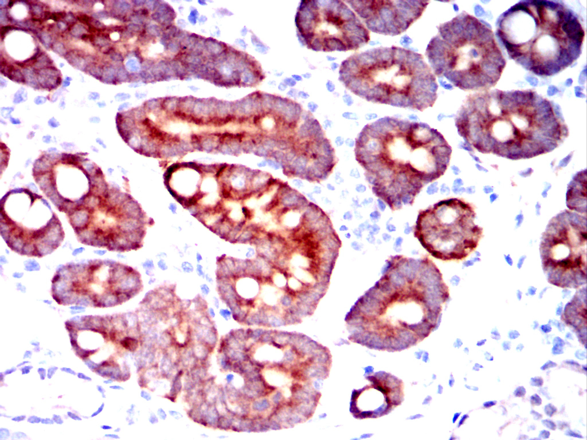 AKR1C1 Mouse mAb[63040]