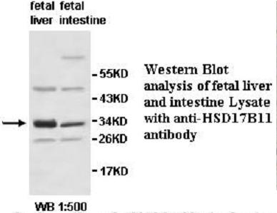 HSD17B11 Antibody[39538]