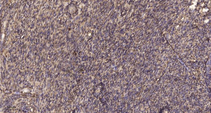 Rac1/CDC42 (phospho-Ser71) rab