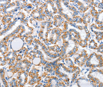 ARL11 Antibody[36261]