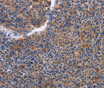 IGSF10 Antibody[35777]