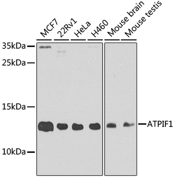 ATPIF1 Rabbit Polyclonal Antib
