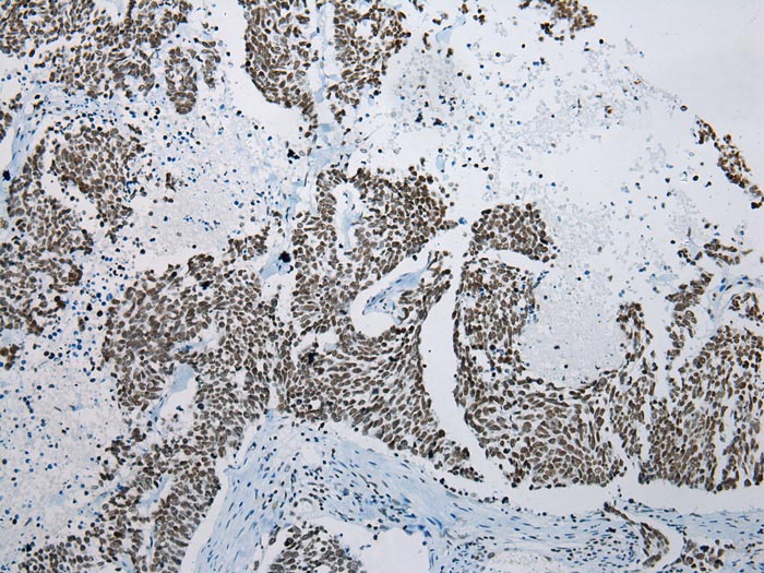 ZNF22 Antibody[42986]