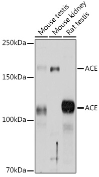 ACE Rabbit Polyclonal Antibody