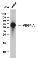 VEGFA Mouse mAb[49212]