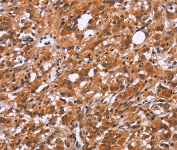 SLC8A2 Antibody[37177]