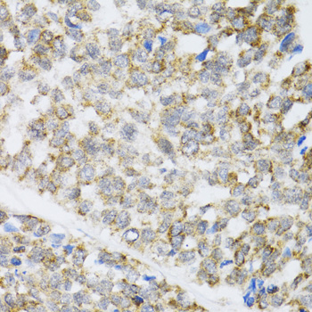 ZAK Rabbit Polyclonal Antibody