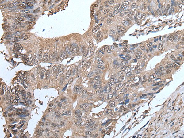 SMC5 Antibody[43637]