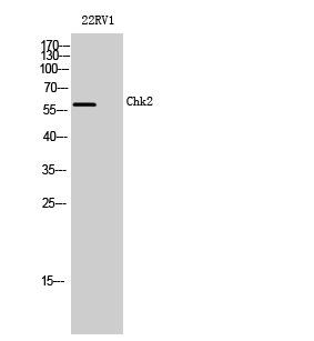 Chk2 Polyclonal Antibody[40741