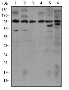 NOS2 Mouse mAb[64007]