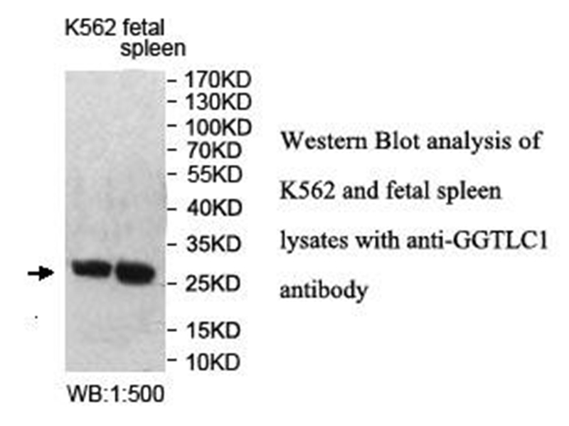GGTLC1 Antibody[40020]