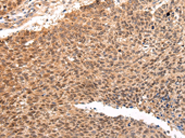 ATF1 Antibody[43228]