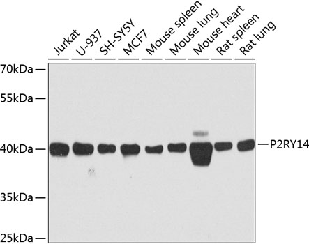 P2RY14 Rabbit Polyclonal Antib