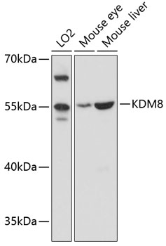 KDM8 Rabbit Polyclonal Antibod