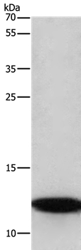 BRK1 Antibody[37618]