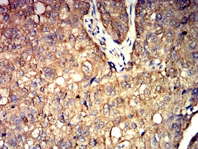 ALDOA Mouse mAb[63049]