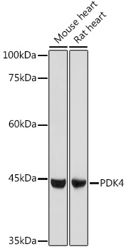 PDK4 antibody[38562]