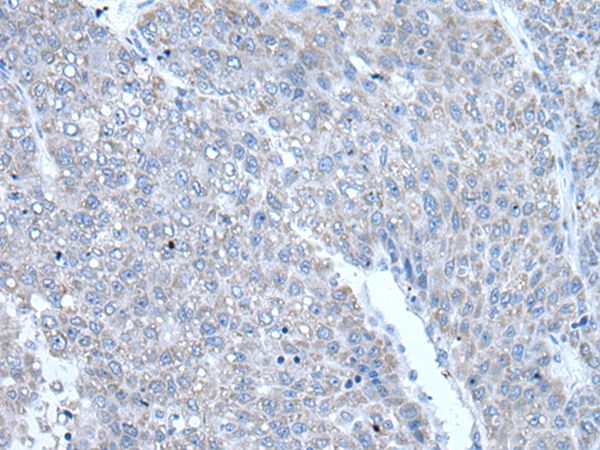 RAC2 Antibody[43907]
