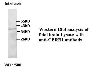 CERB1 Antibody[39430]