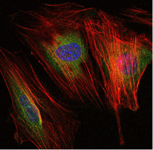 MMP-9 Monoclonal Antibody[4918