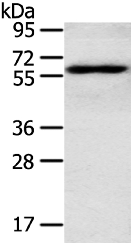 RORA Antibody[40212]