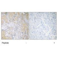 PSMD3 Antibody[34308]