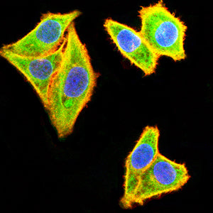 IL10RB Mouse mAb[63777]